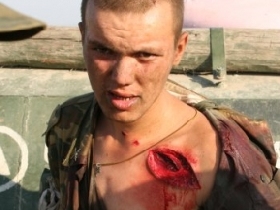 Раненый солдат, фото Аркадия Бабченко, "Новая газета"